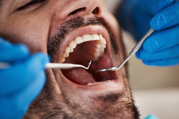 Best Emergency Dental Care for Broken or Chipped Teeth in Hamilton, OH